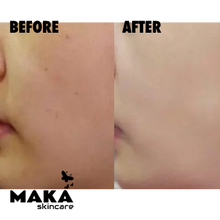 BB Glow Foundation - South Woodford