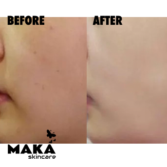 BB Glow Foundation - South Woodford