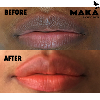 Lip Contour  and Full Lip Blush - MAKASkincare
