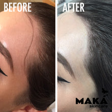 Female Hairloss Microblading | South Woodford | Mayfair