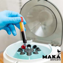PRP | Platelet Rich Plasma | South Woodford | Mayfair | MAKASkincare