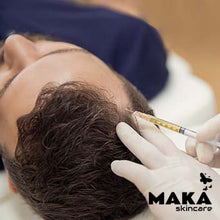 PRP | Platelet Rich Plasma | South Woodford | Mayfair | MAKASkincare