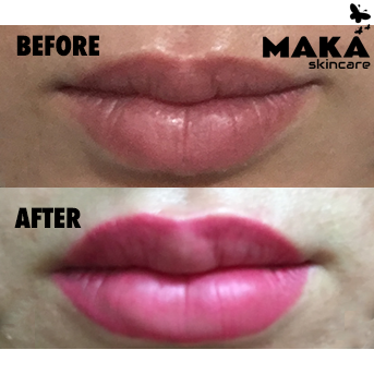 Semi Permanent Lip Liner & Blush - Medicare Cosmetics