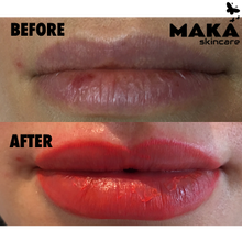 Lip Contour and Full Lip Blush - MAKASkincare